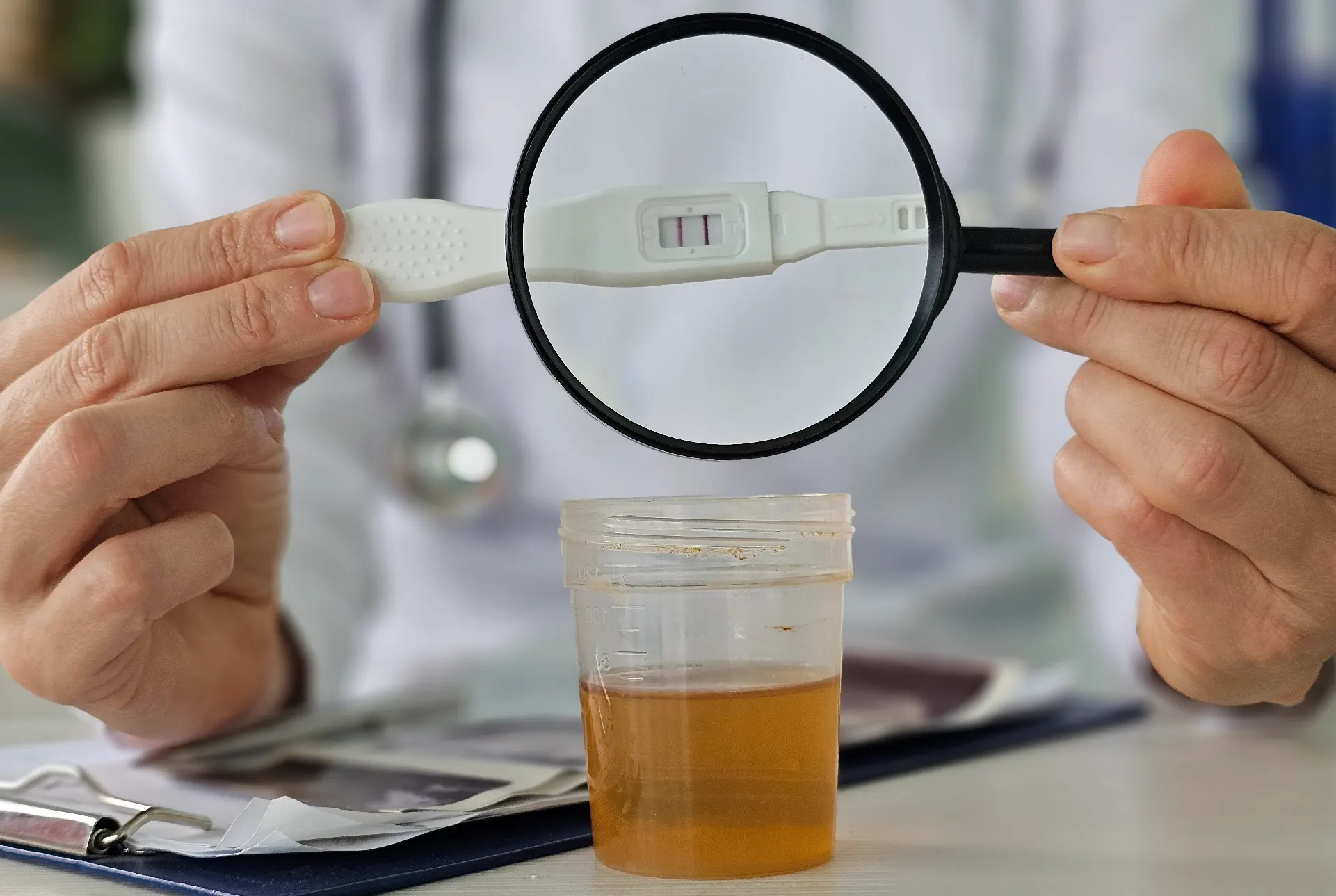 What Tests Should Be Done Before IVF